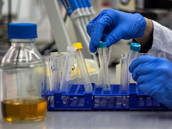 OTKRIVAMO: Virusi hepatitisa B postojali i u kameno doba OTKRIVAMO: Virusi hepatitisa B postojali i u kameno doba
