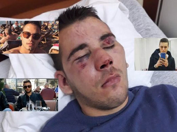 (FOTO): BRUTALNO IŽIVLJAVANJE: Pijani sinovi bahatih SNS-ovaca pretukli mladića! (FOTO): BRUTALNO IŽIVLJAVANJE: Pijani sinovi bahatih SNS-ovaca pretukli mladića!