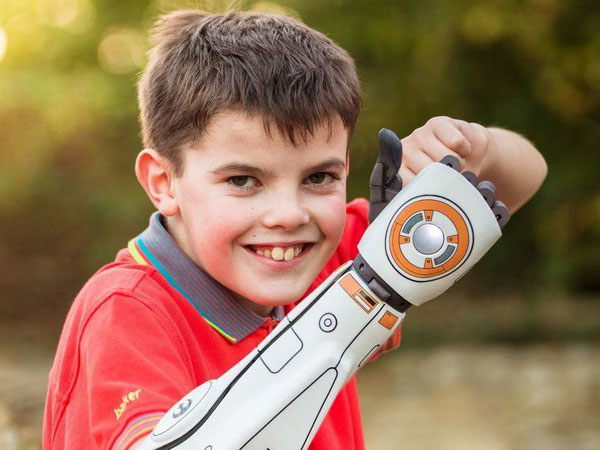 Open Bionics kreira 3D štampane bioničke ruke Open Bionics kreira 3D štampane bioničke ruke